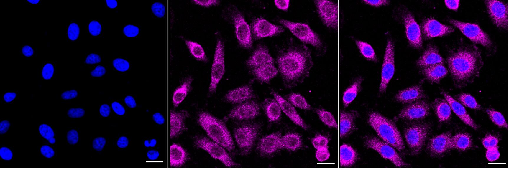 PKC gamma Antibody (24GB4495)