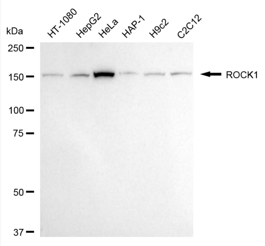 ROCK1 Antibody (24GB4535)