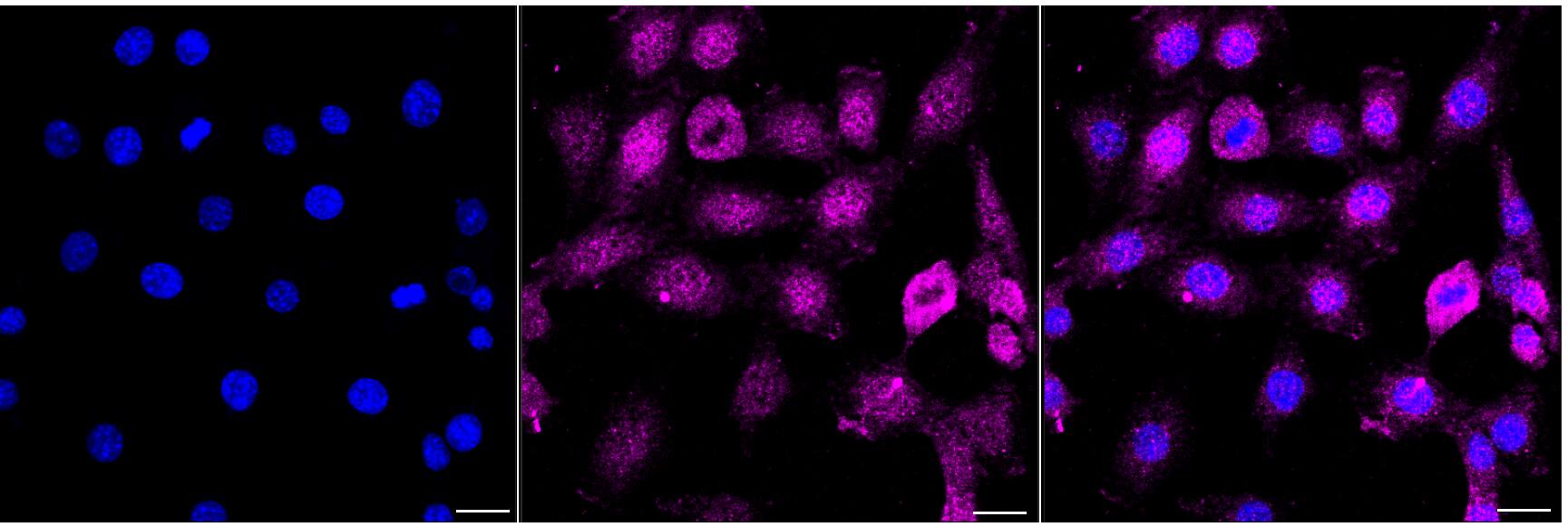 Alpha Actinin 3 Antibody (24GB4680)