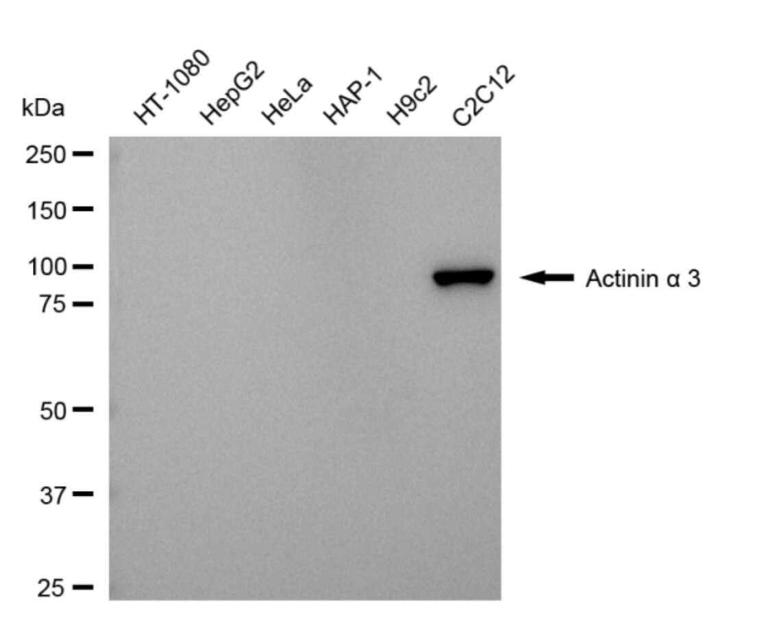 Alpha Actinin 3 Antibody (24GB4680)