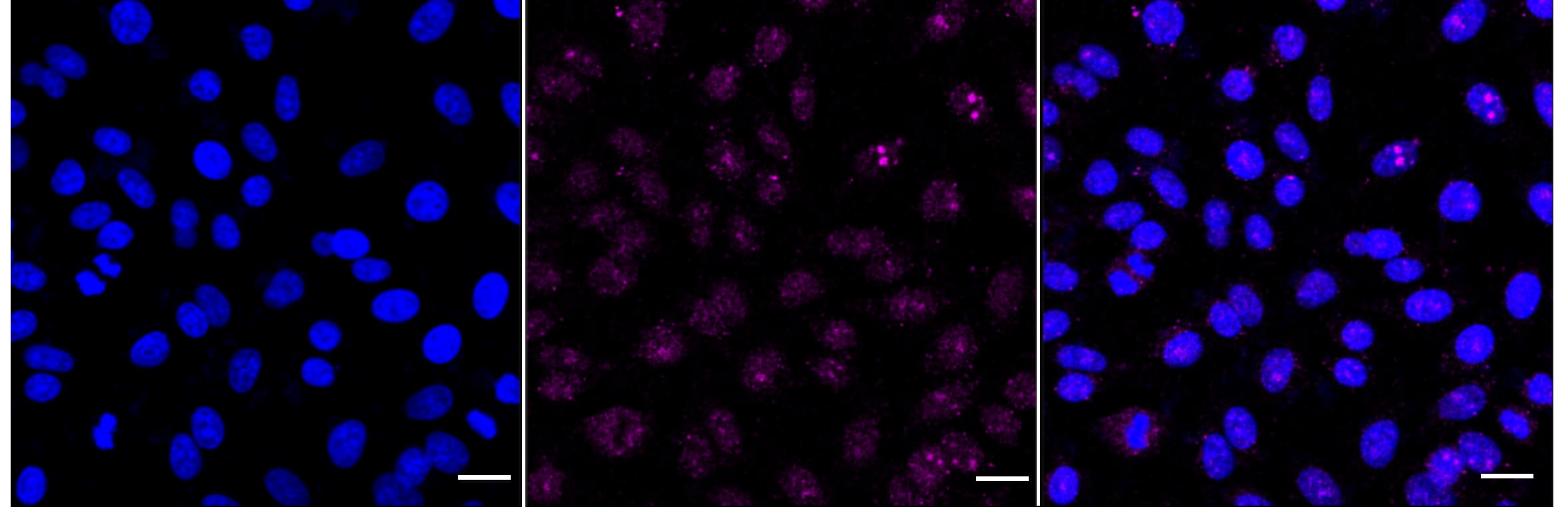 Activin RIIB Antibody (24GB4690)