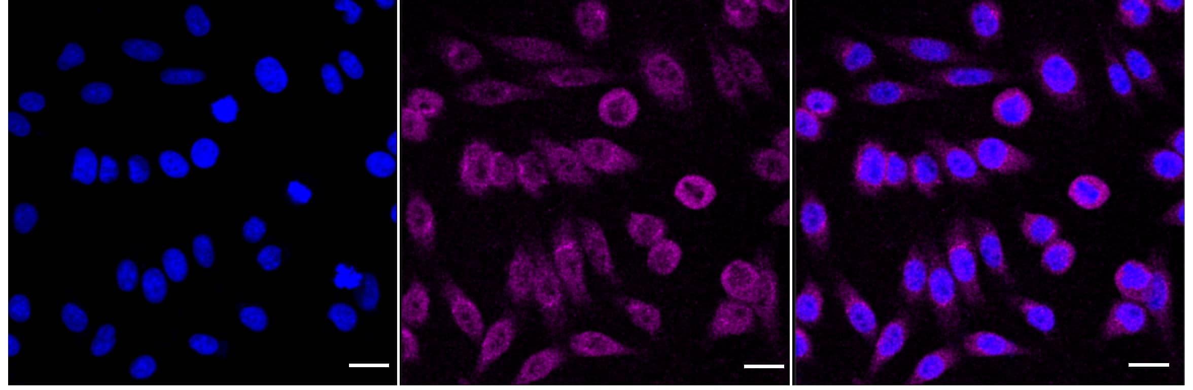 alcohol dehydrogenase 5 Antibody (24GB4695)