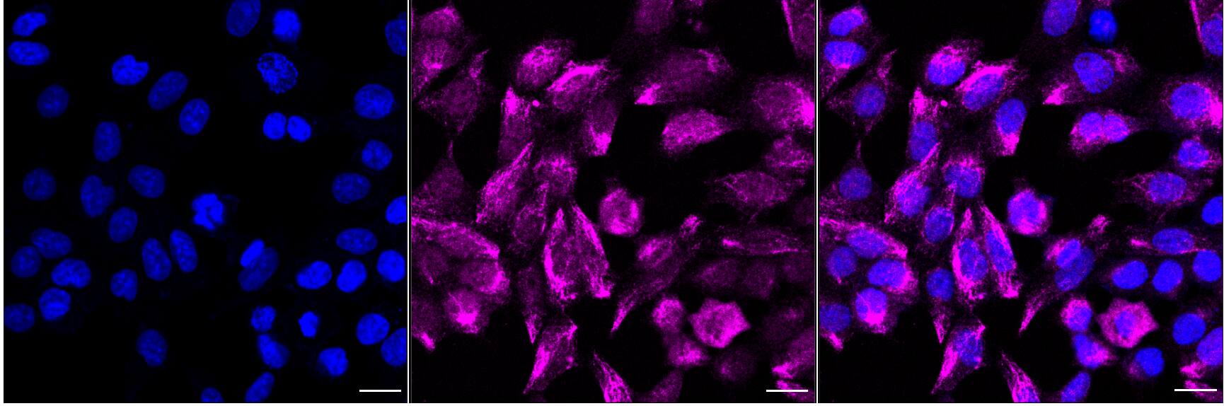 Smad1 [p Ser465] Antibody (24GB5090)