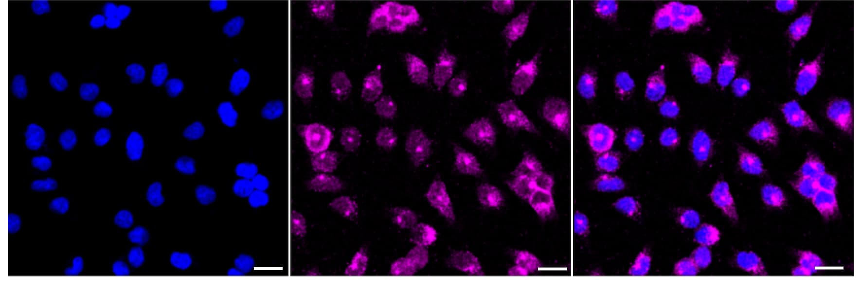 SSX2IP Antibody (24GB5255)