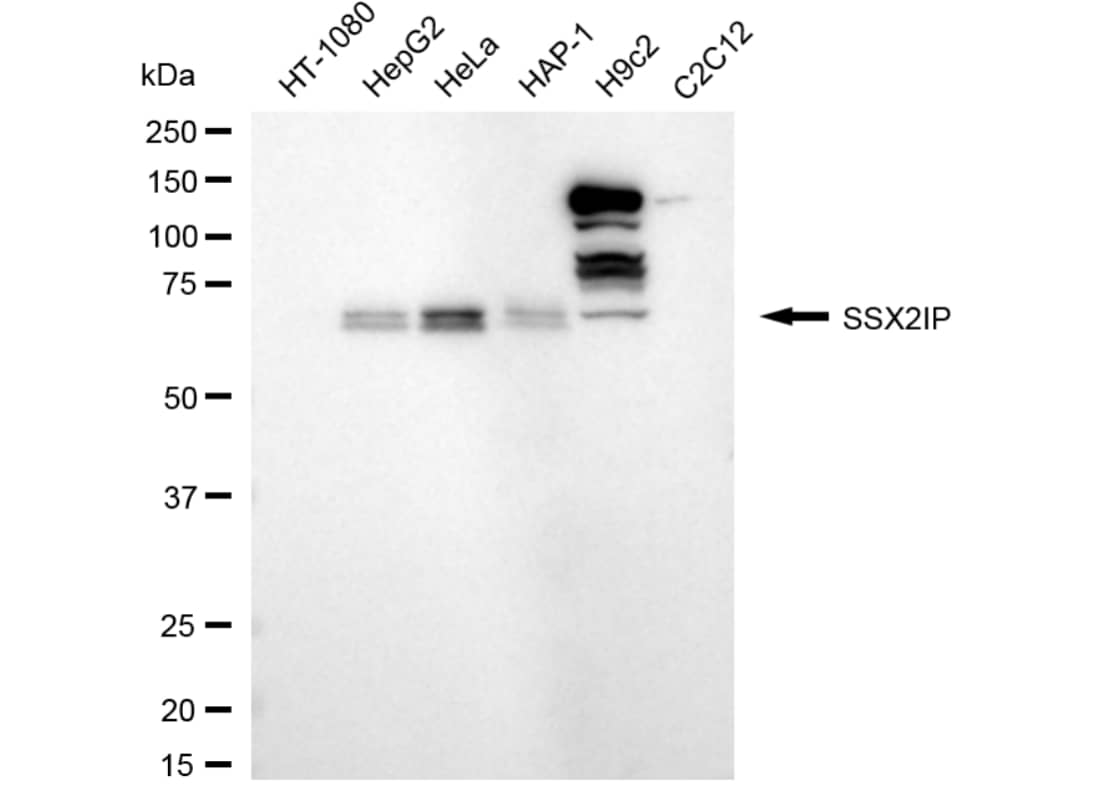 SSX2IP Antibody (24GB5255)