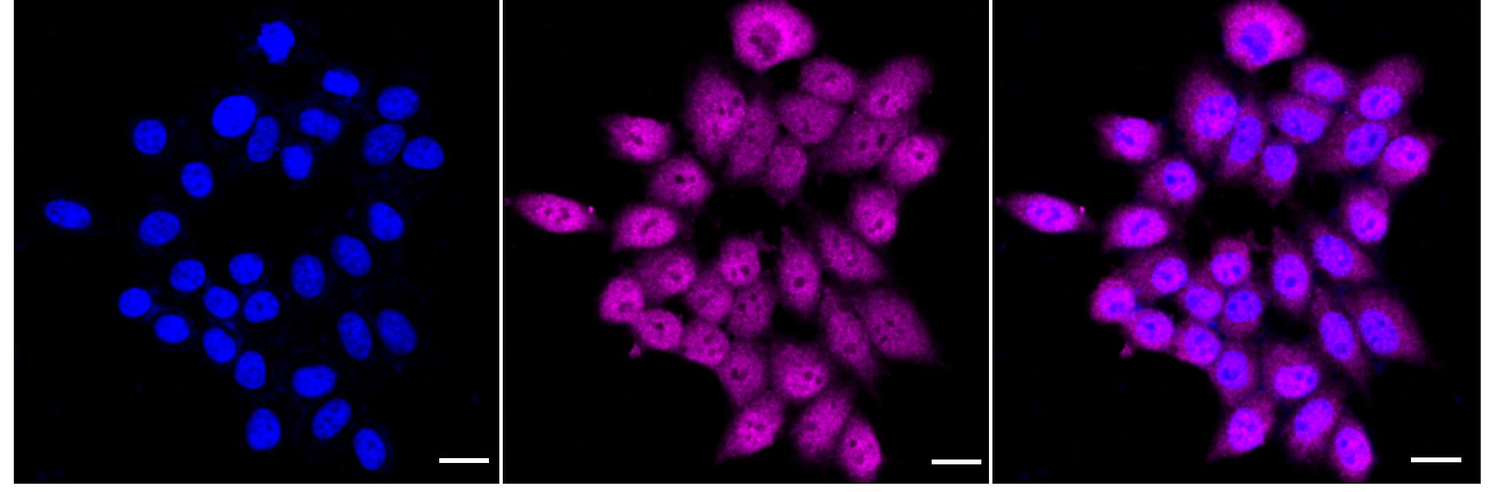 TNPO3 Antibody (24GB5295)