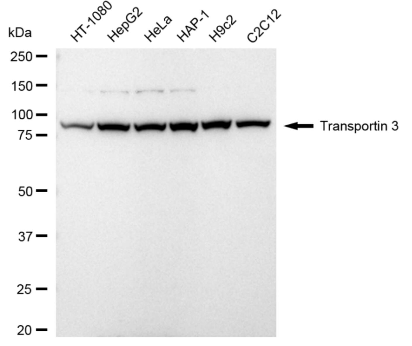 TNPO3 Antibody (24GB5295)