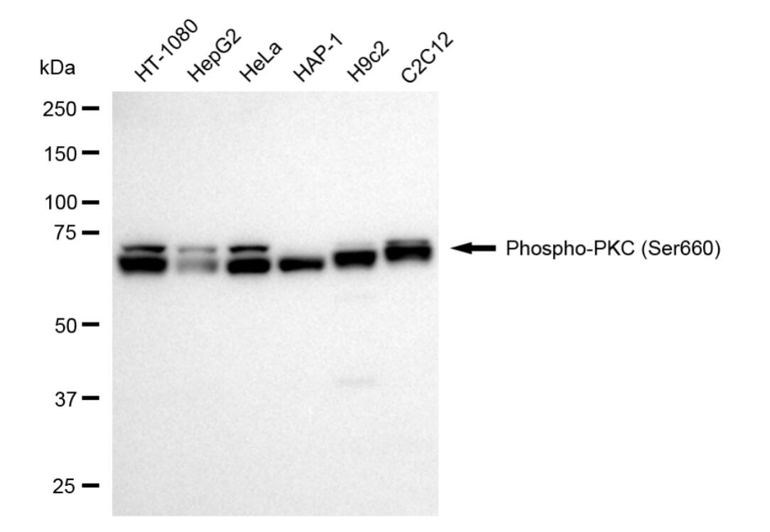 pan PKC [p Ser660] Antibody (24GB5450)