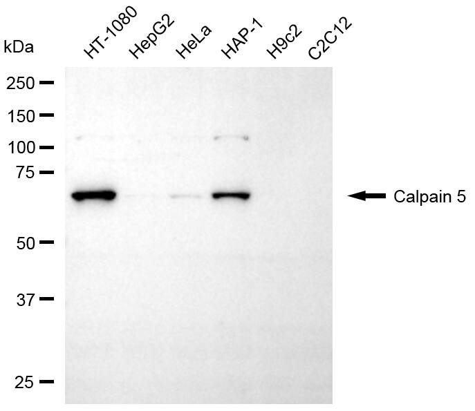 Calpain 5 Antibody (24GB8005)