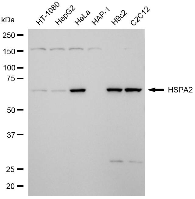 HSPA2 Antibody (24GB13655)
