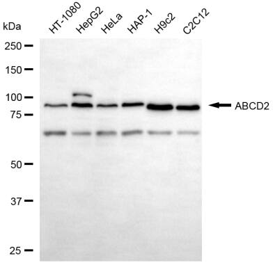 ABCD2 Antibody (24GB14095)