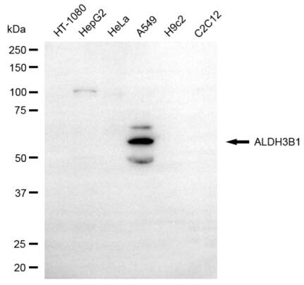 ALDH3B1 Antibody (24GB14115)