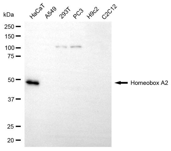 HOXA2 Antibody (24GB14150)