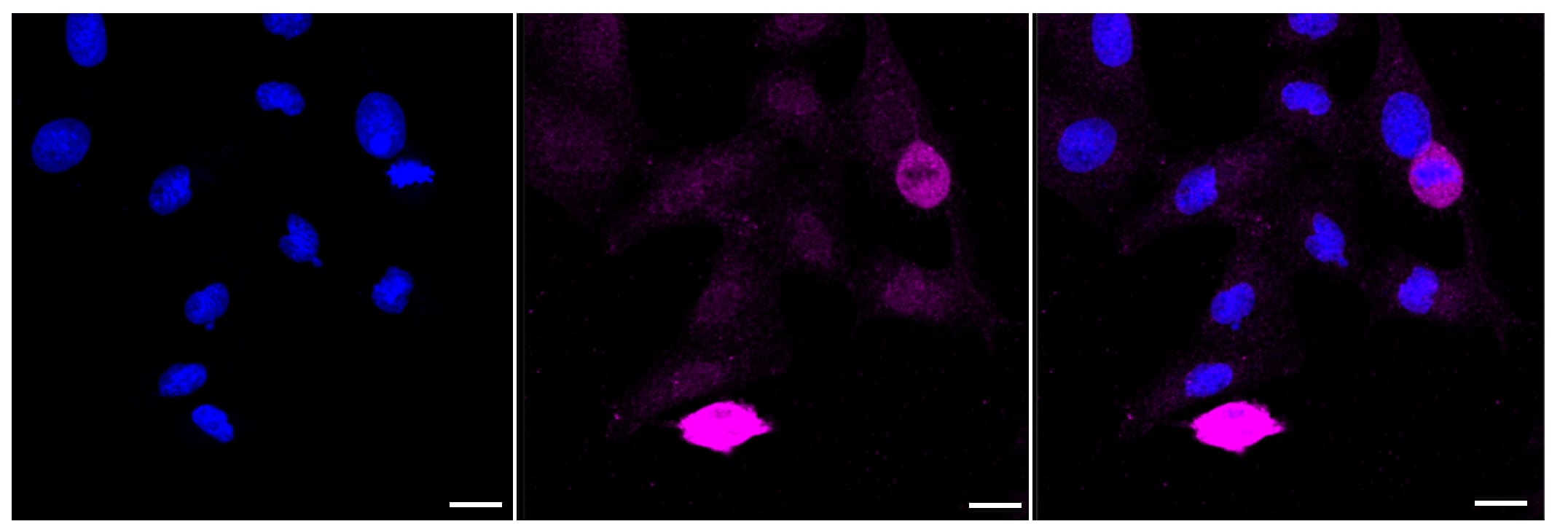 PIK3CA Antibody (23GB950)