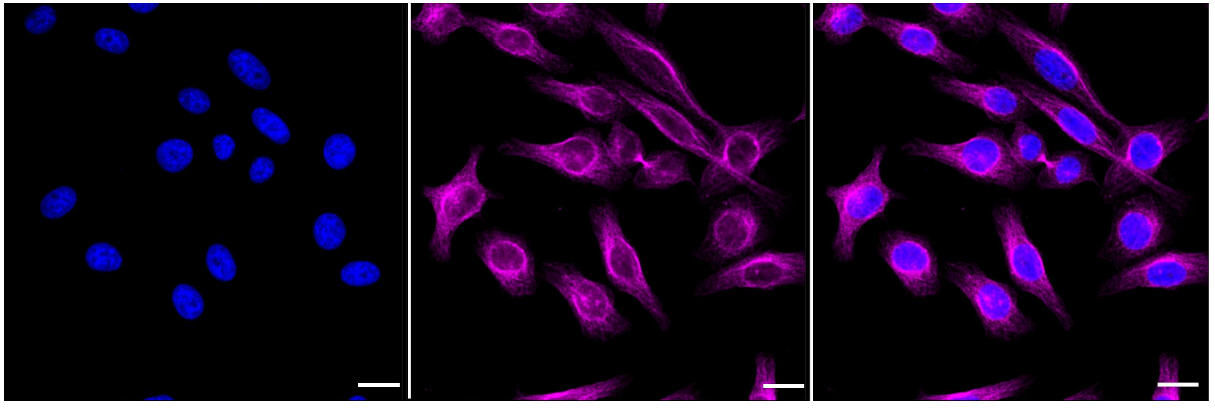 alpha-1A Adrenergic R/ADRA1A Antibody (23GB1655)