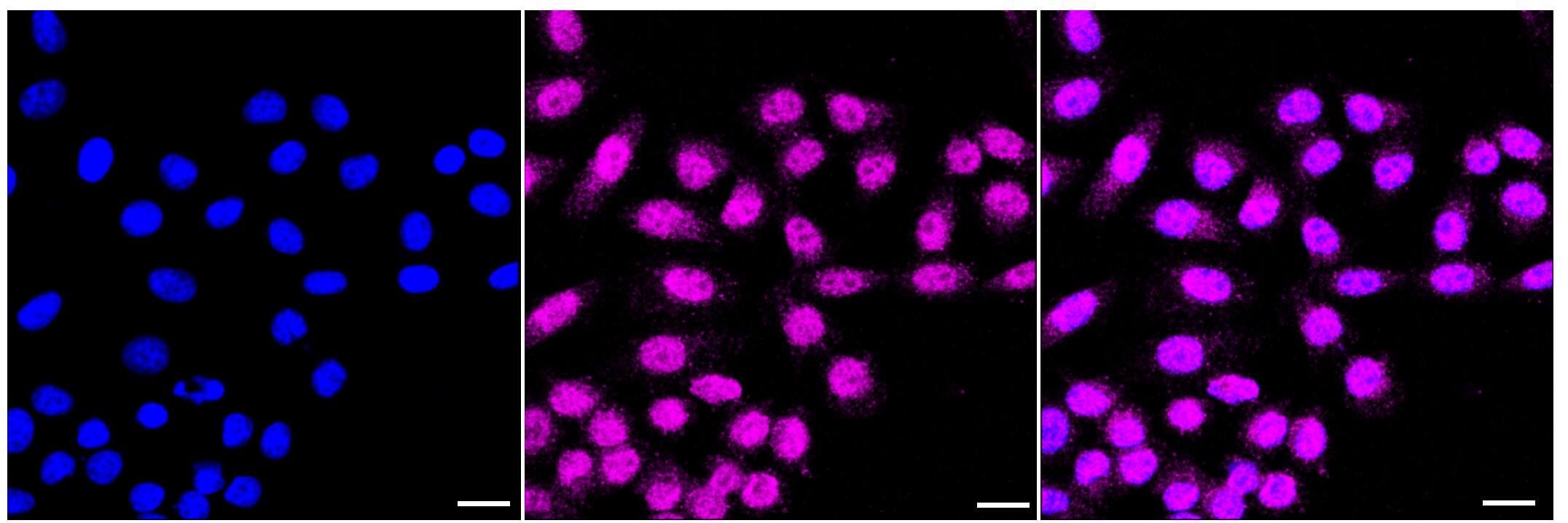 ABH1 Antibody (23GB1265)