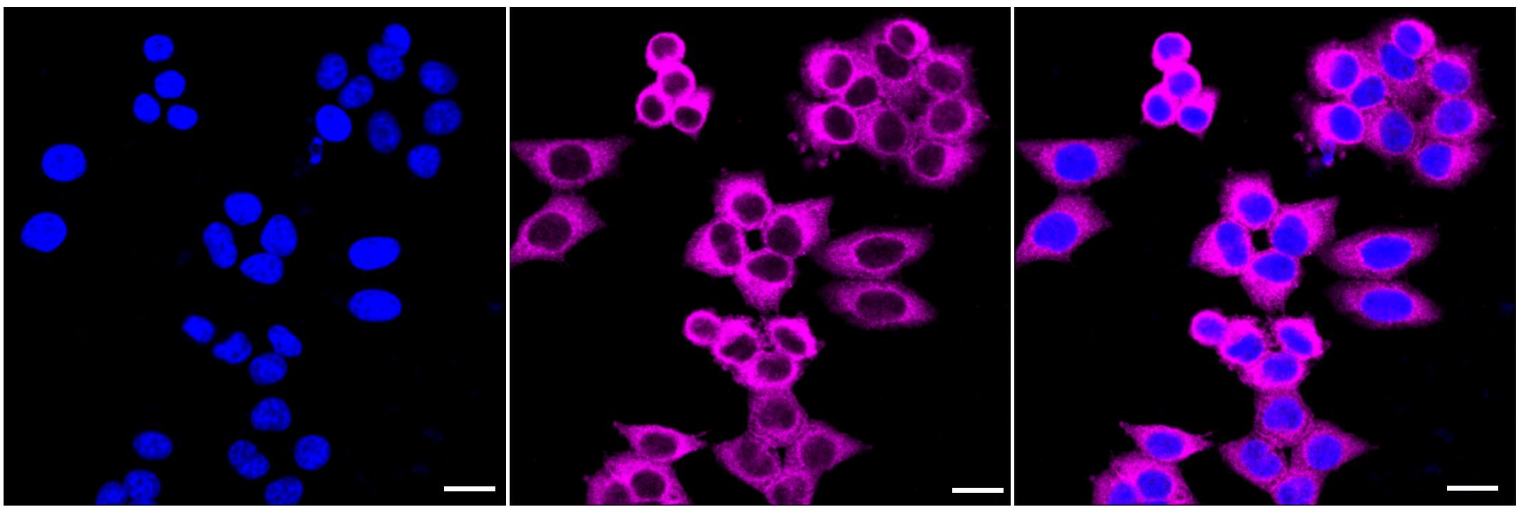 DIAPH1 Antibody (23GB1990)