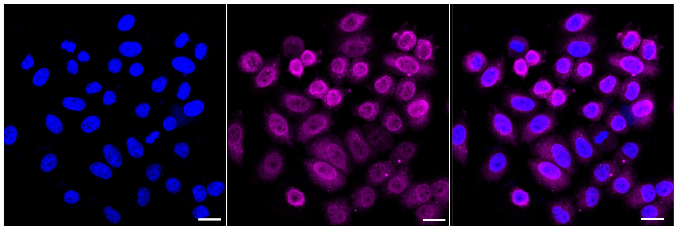 Importin alpha 2/KPNA2 Antibody (24GB5955)