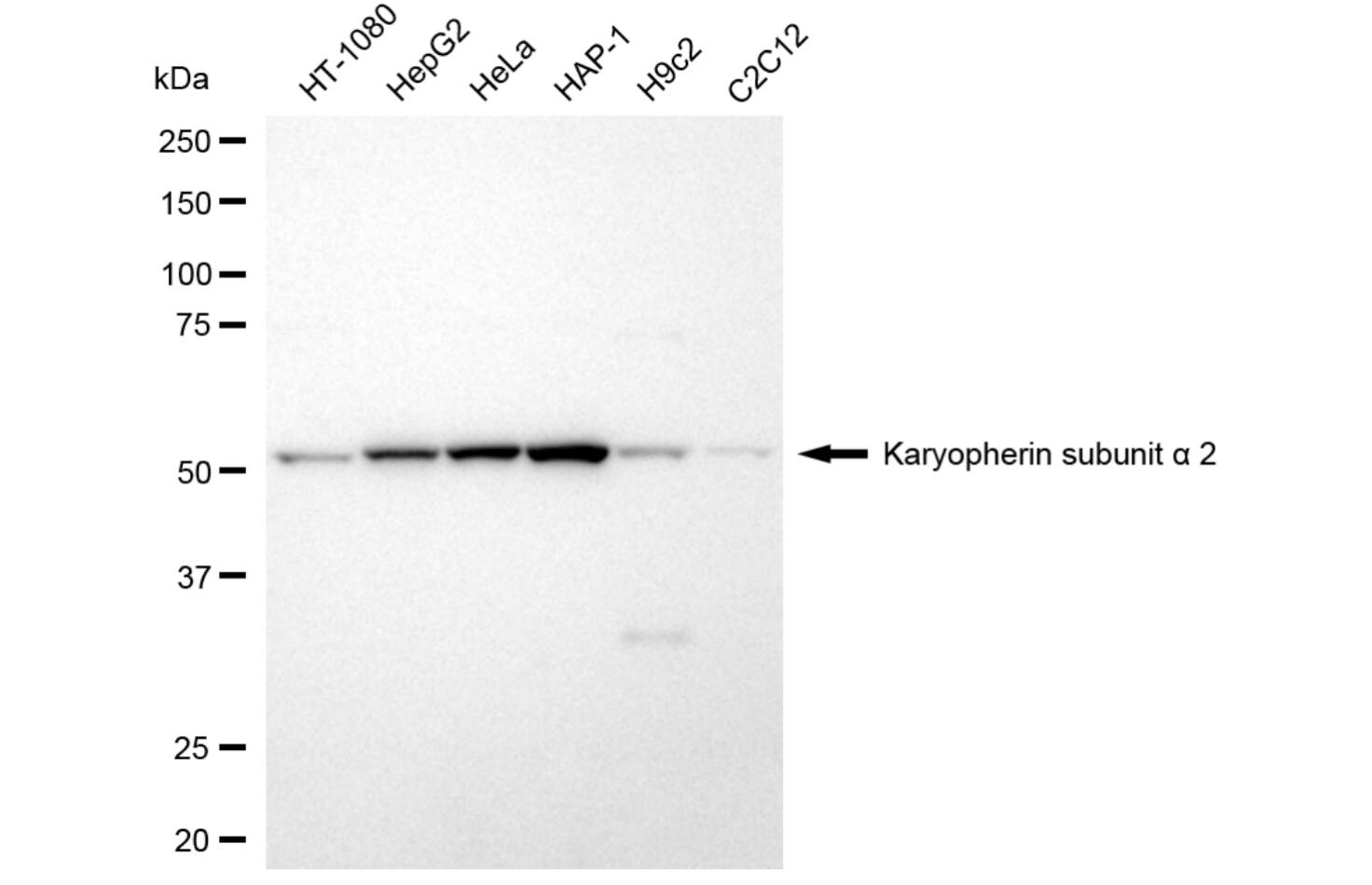 Importin alpha 2/KPNA2 Antibody (24GB5955)