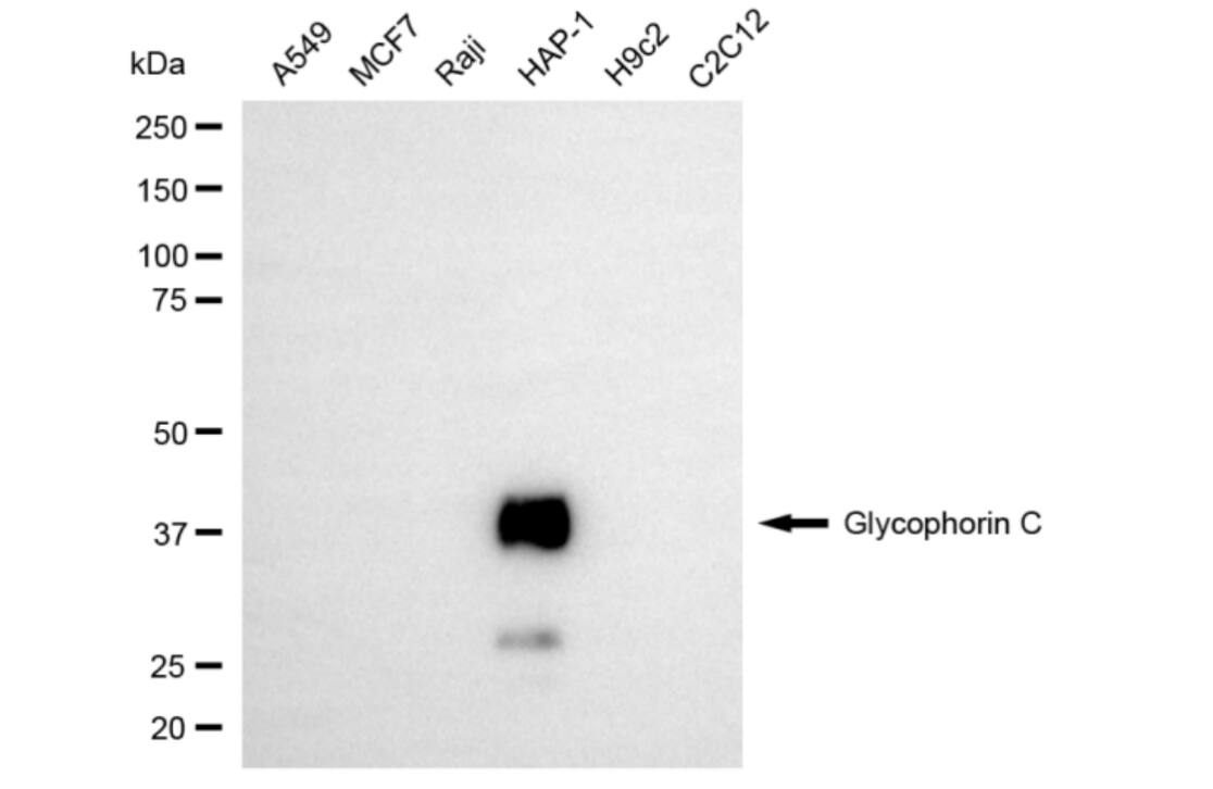 Glycophorin C Antibody (24GB5960)