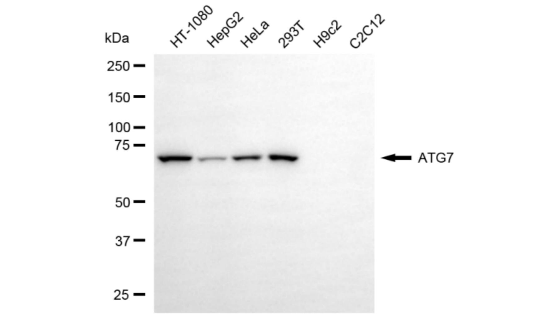 ATG7 Antibody (24GB5975)