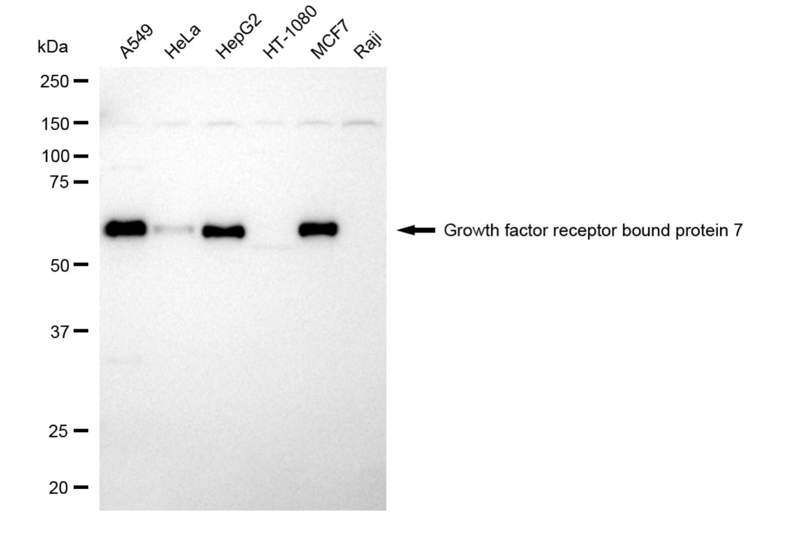 GRB7 Antibody (24GB6000)
