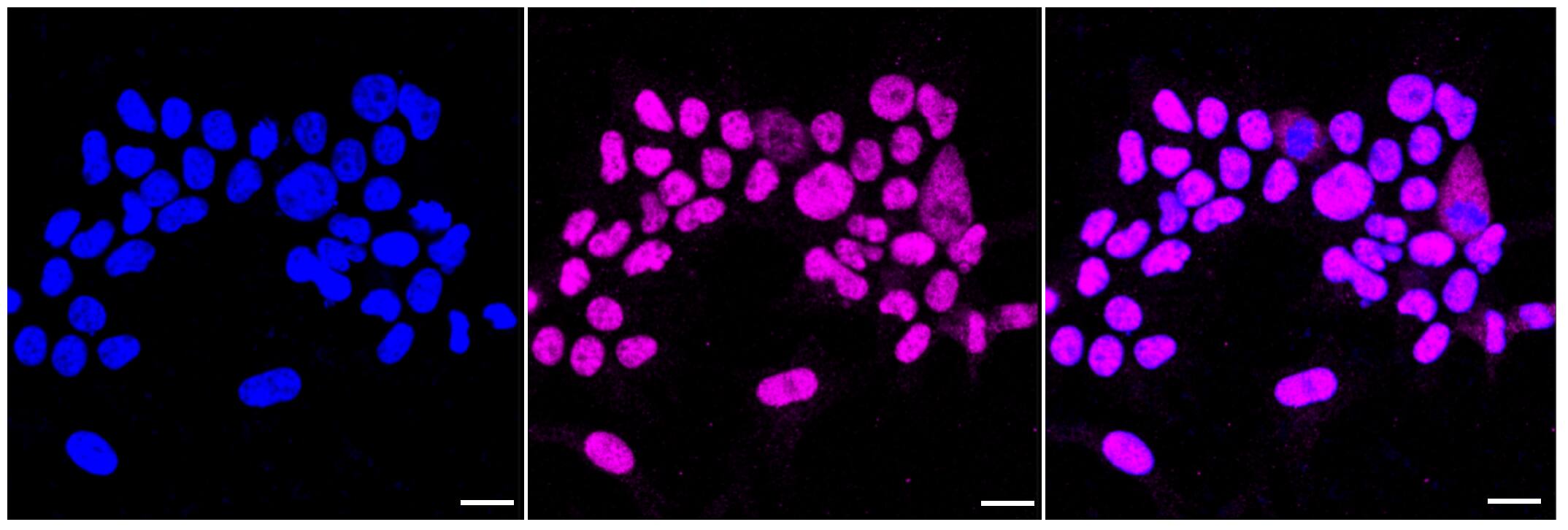 KAT1 Antibody (23GB2090)