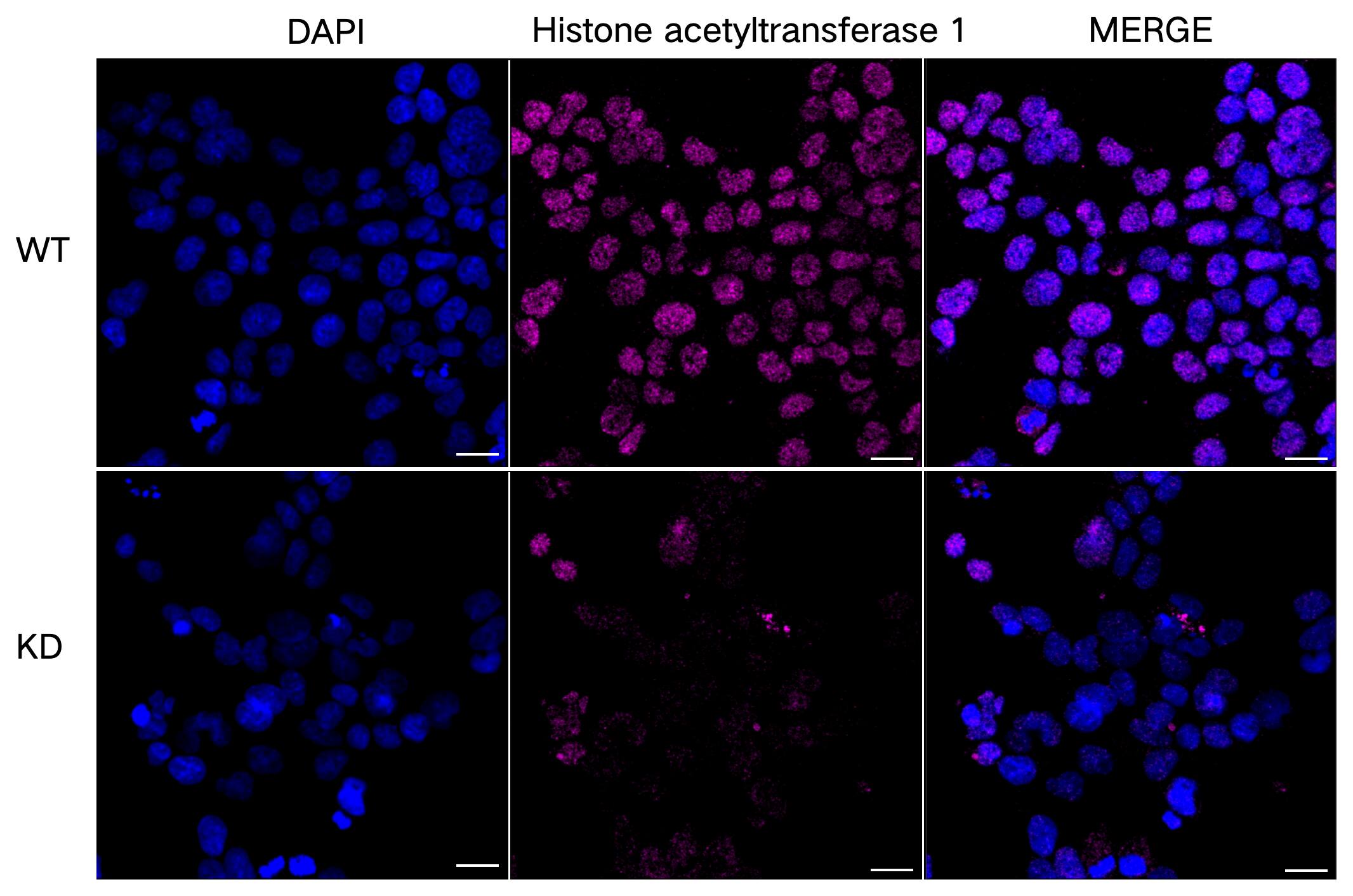 KAT1 Antibody (23GB2090)