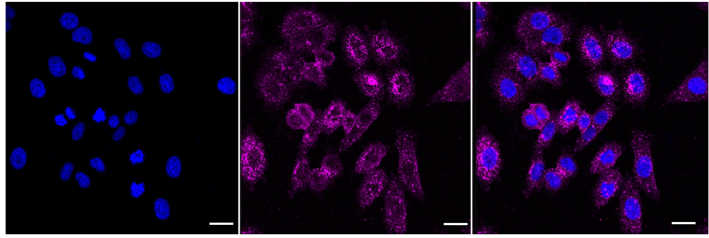 gamma Catenin Antibody (24GB6055)