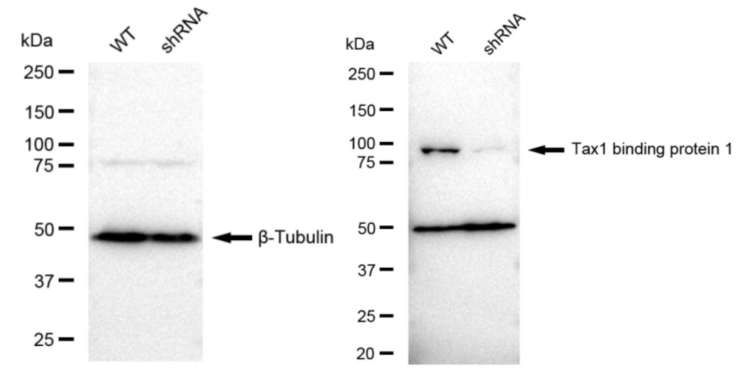 TAX1BP1 Antibody (23GB2100)
