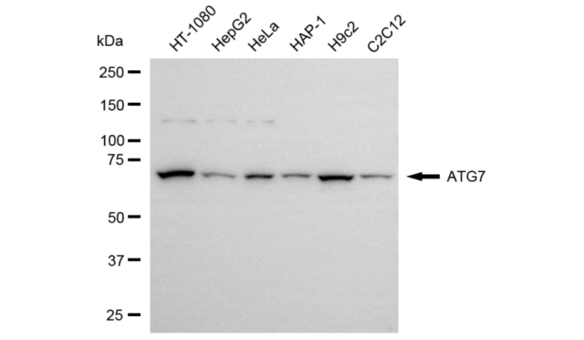 ATG7 Antibody (24GB6075)