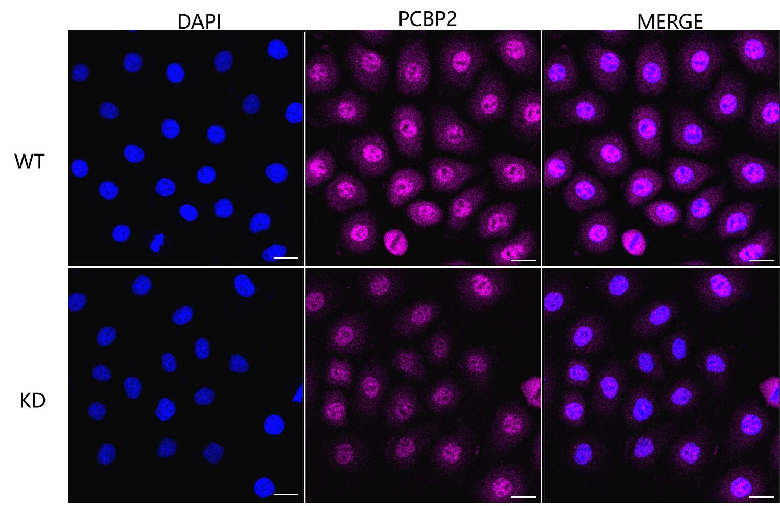 PCBP2 Antibody (23GB2110)