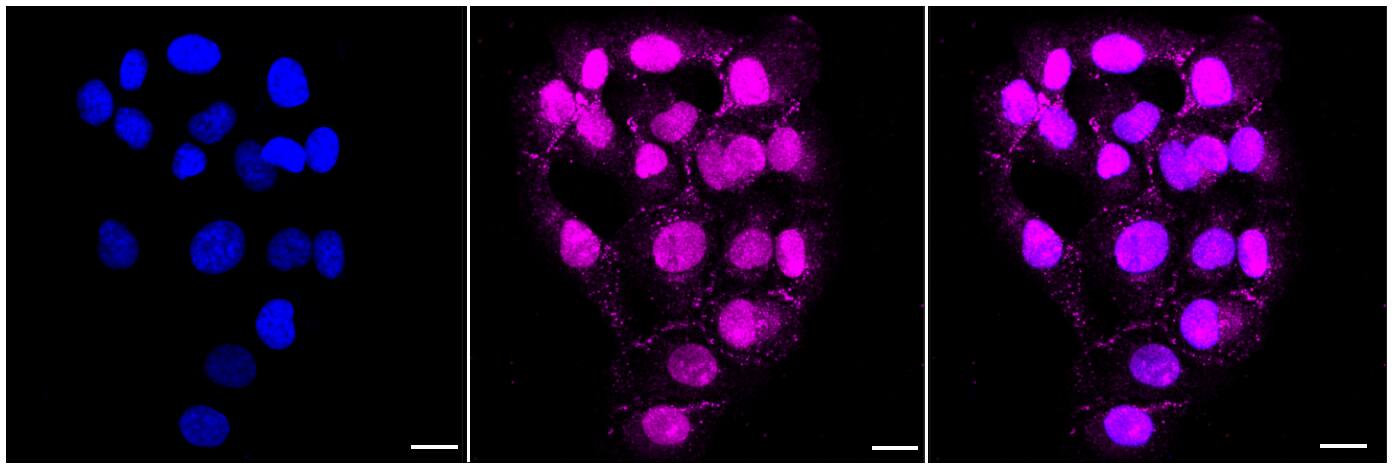 Activin B/Inhibin beta B Antibody (24GB6100)