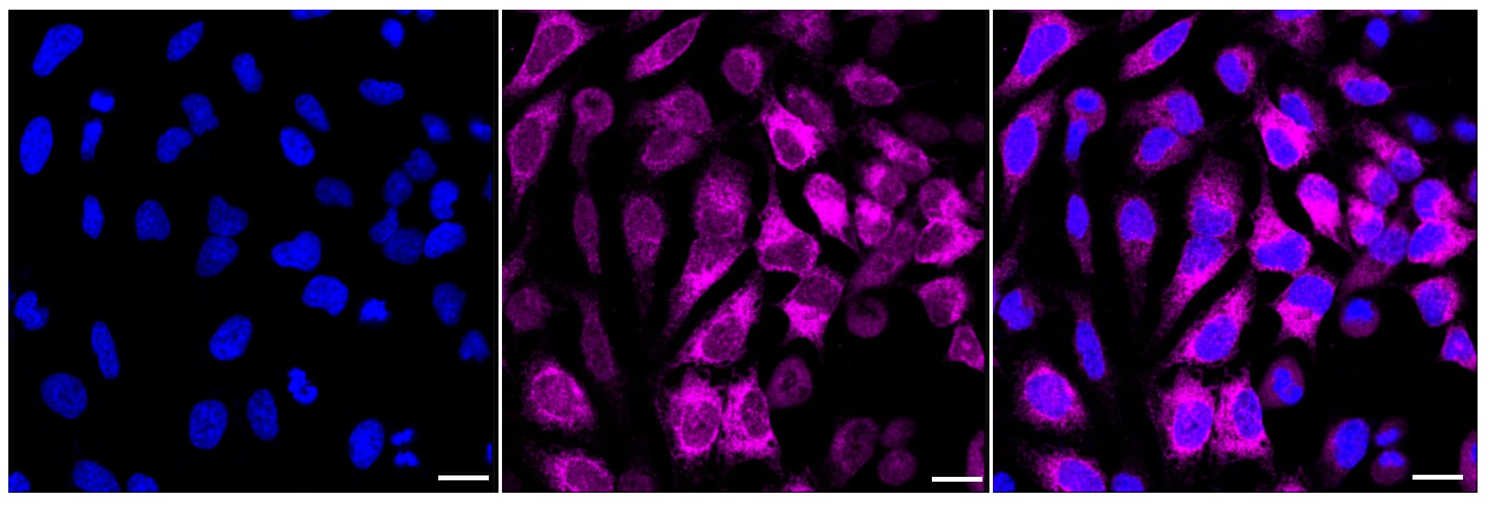 Integrin alpha V/CD51 Antibody (23GB2240)