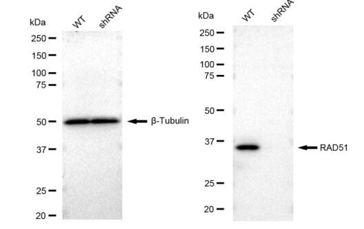 Rad51 Antibody (23GB2275)