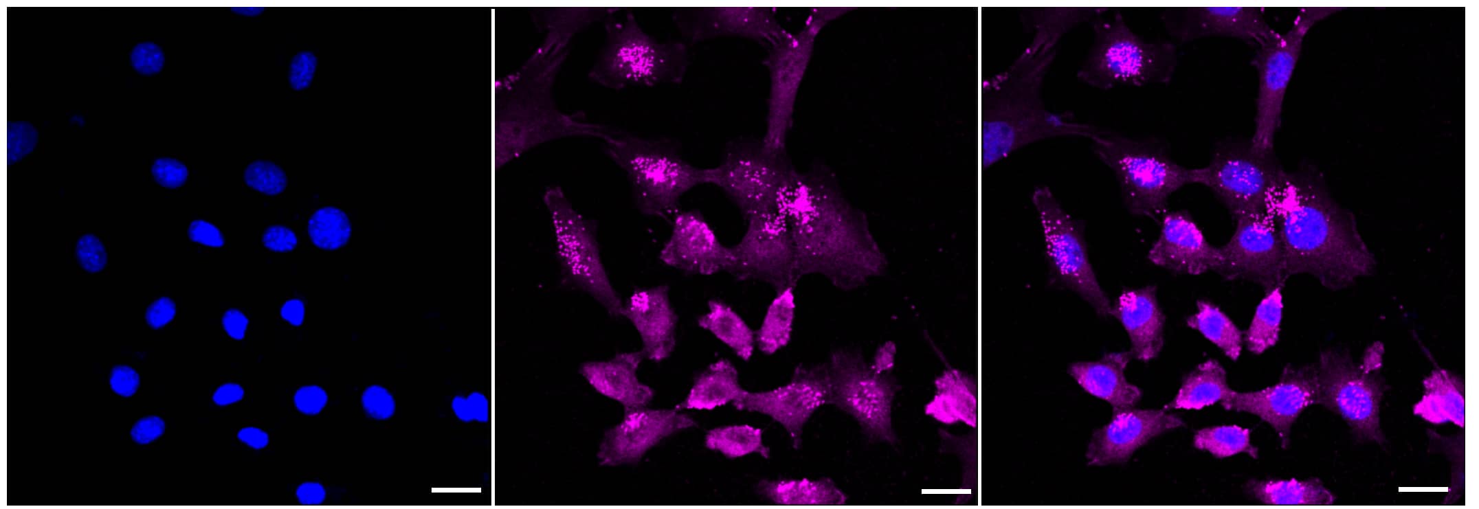 CHIP/STUB1 Antibody (23GB2345)