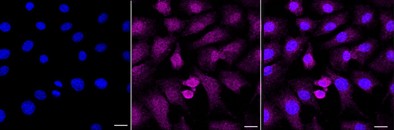Adenylosuccinate Synthase Antibody (23GB630)