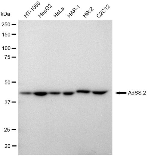 Adenylosuccinate Synthase Antibody (23GB630)