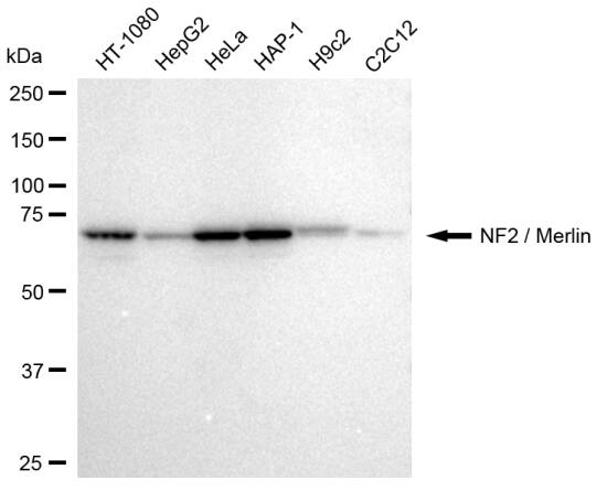 NF2/Merlin Antibody (23GB2620)