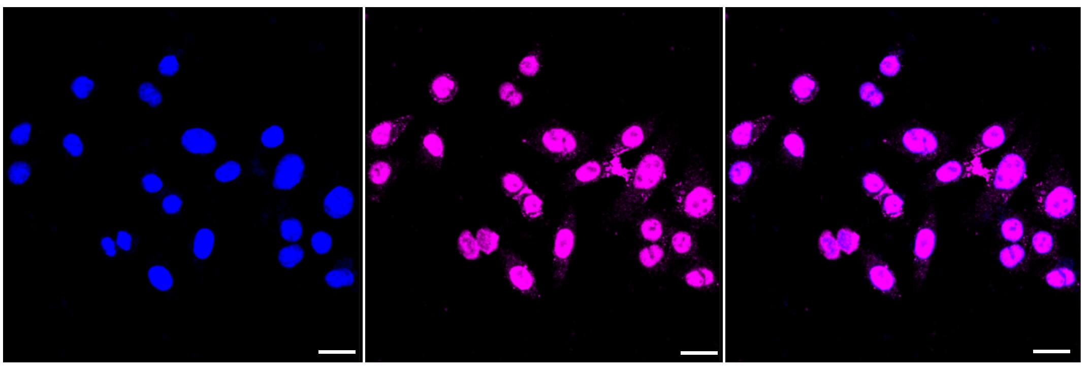 BRMS1 Antibody (23GB3015)