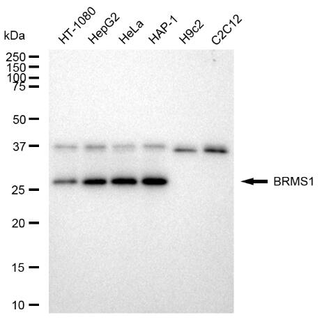 BRMS1 Antibody (23GB3015)