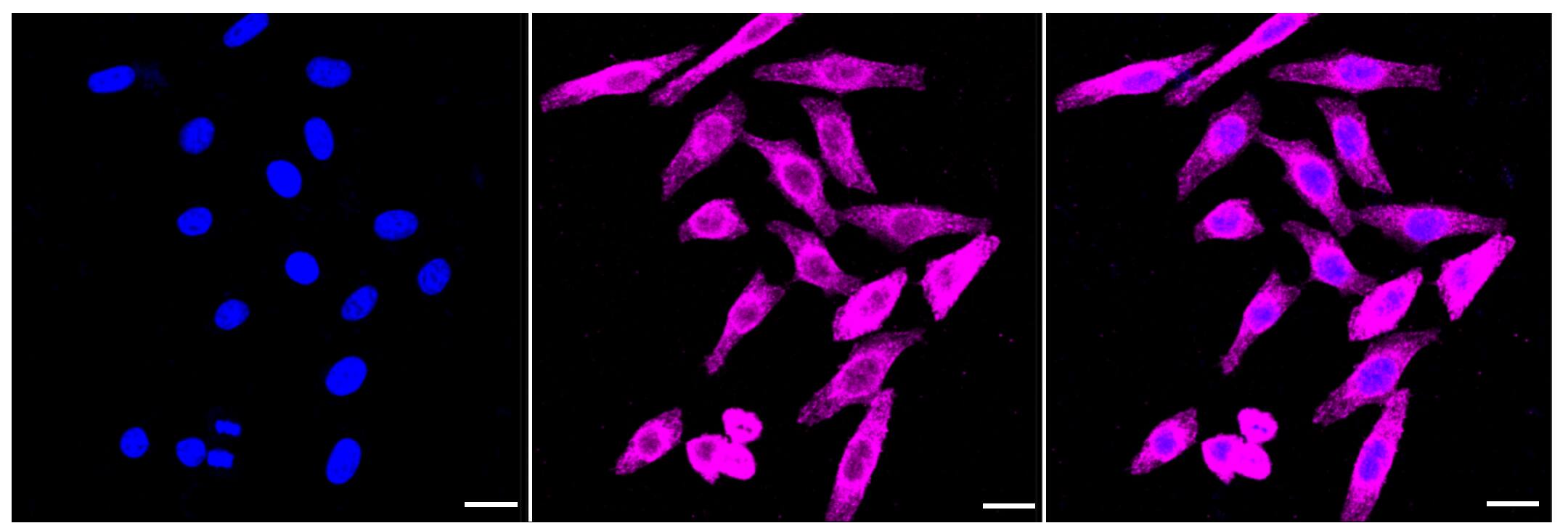 CLIP170 Antibody (23GB3080)