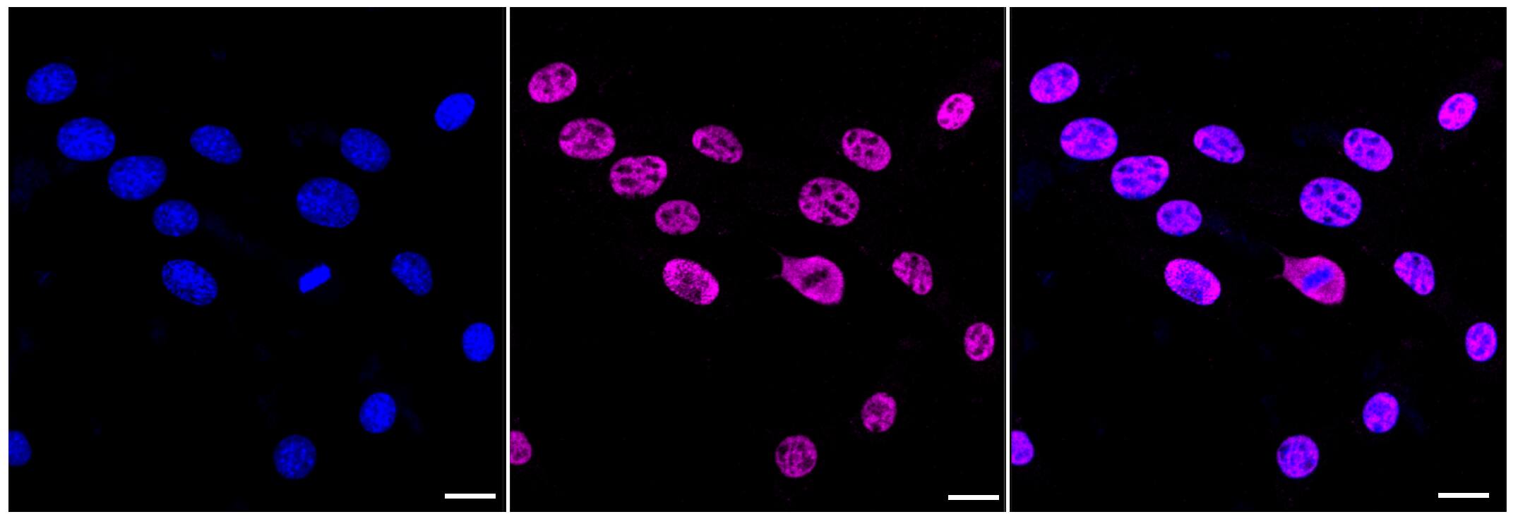 AKAP95/AKAP8 Antibody (23GB2970)