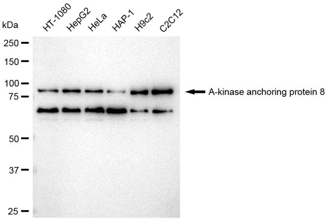 AKAP95/AKAP8 Antibody (23GB2970)