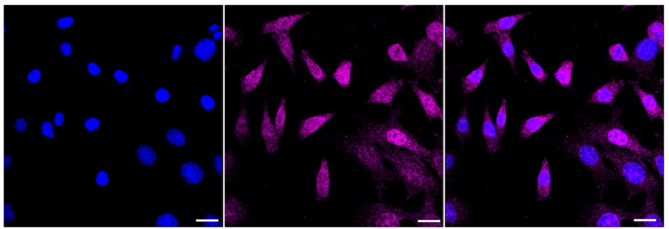 Androgen R/NR3C4 Antibody (23GB2975)