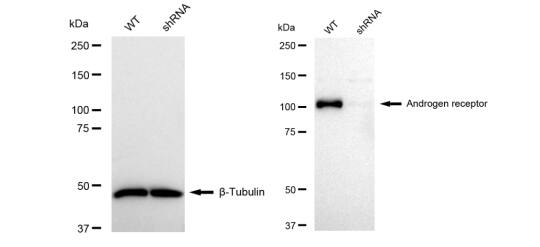 Androgen R/NR3C4 Antibody (23GB2975)