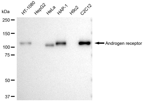 Androgen R/NR3C4 Antibody (23GB2975)