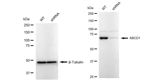 ABCD1 Antibody (23GB3125)