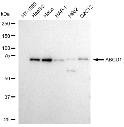 ABCD1 Antibody (23GB3125)