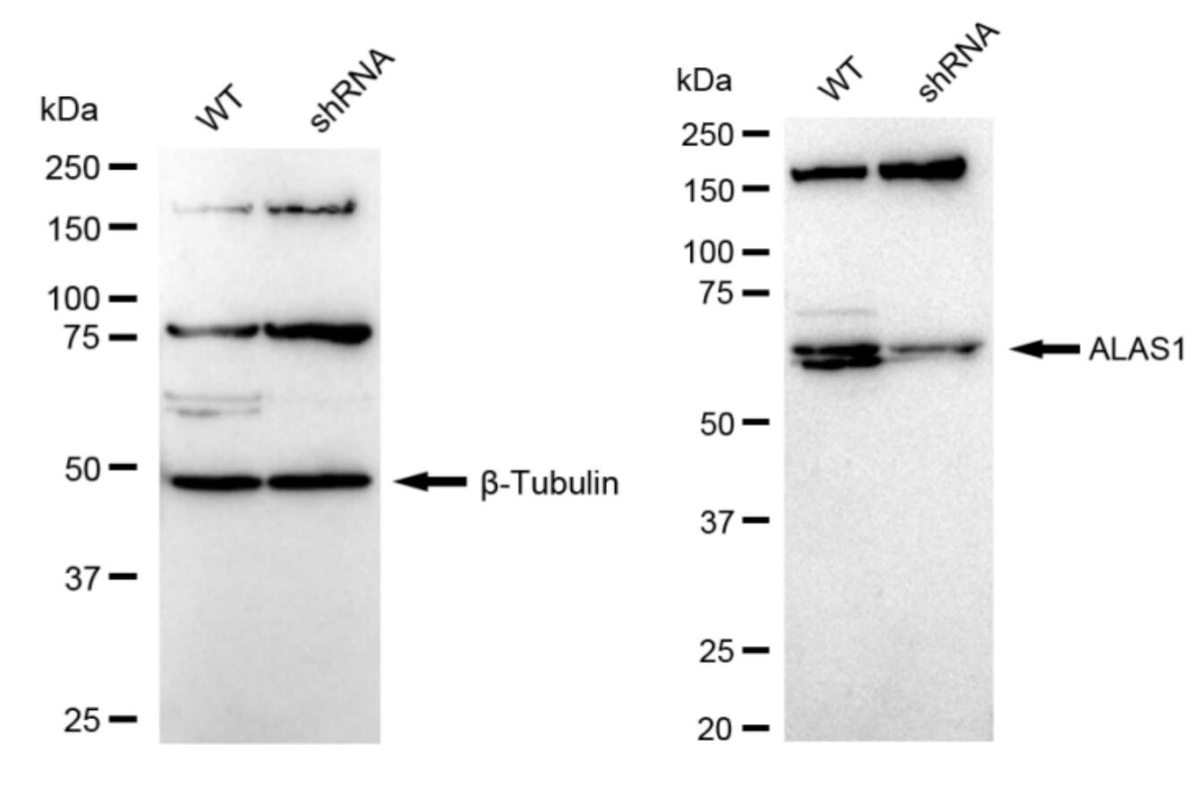 Alas1 Antibody (23GB3190)